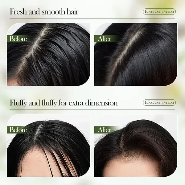 Sadoer Volumizing Anti-dandruff Removal Oil-control Fluffy Rosemary Shampoo Hair