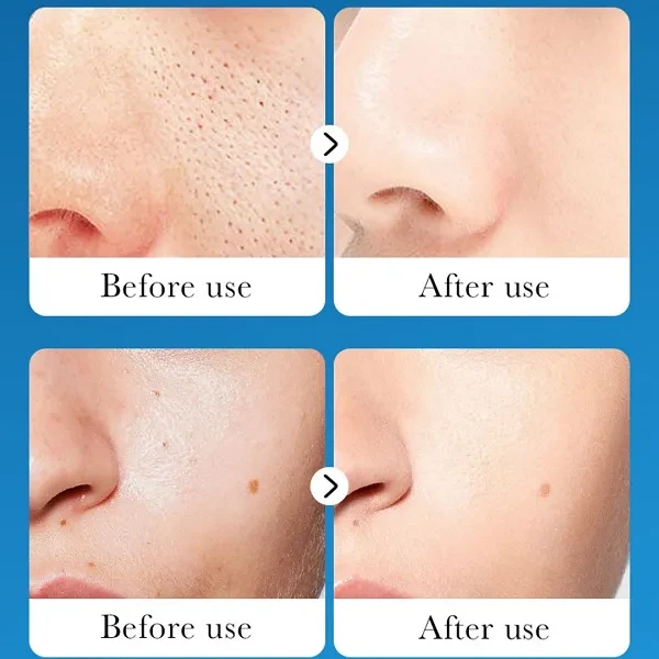 Sadoer Peel-off Black Mask Dead Sea Mud Rich Minerals Clean Oil Control Blackhea