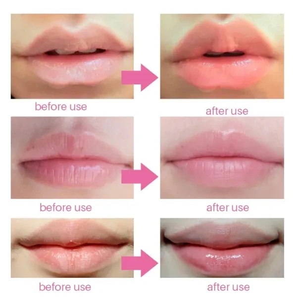 4 Pieces Lip Mask Hydrating Brighten Pink Lips Gel Smoothing Lip Care Fruit Seri