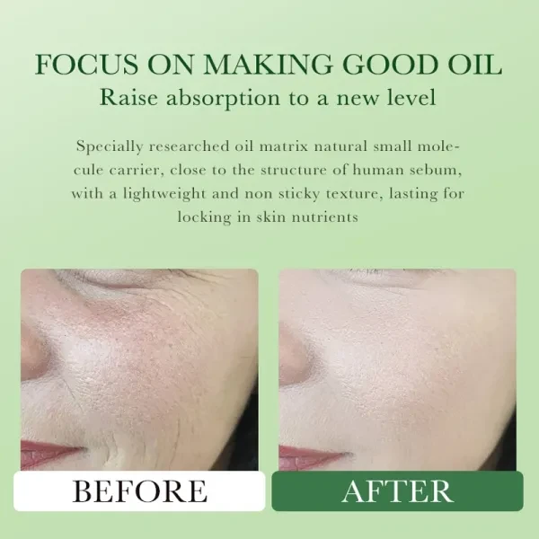 Natural Avocado Oil Anti-aging Firming Facial Massage Oil Soothing Moisturizing