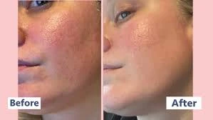 Paula's Choice SKIN PERFECTING 2% BHA Liquid Salicylic Acid Exfoliant - Facial E