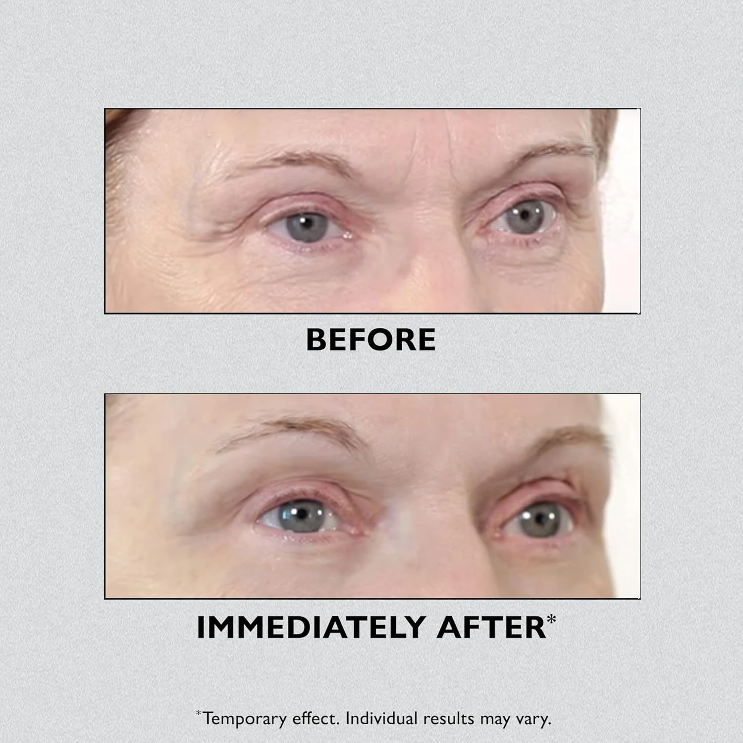 PETER THOMAS ROTH Instant FirmX™ Eye 30ml/1 fl oz