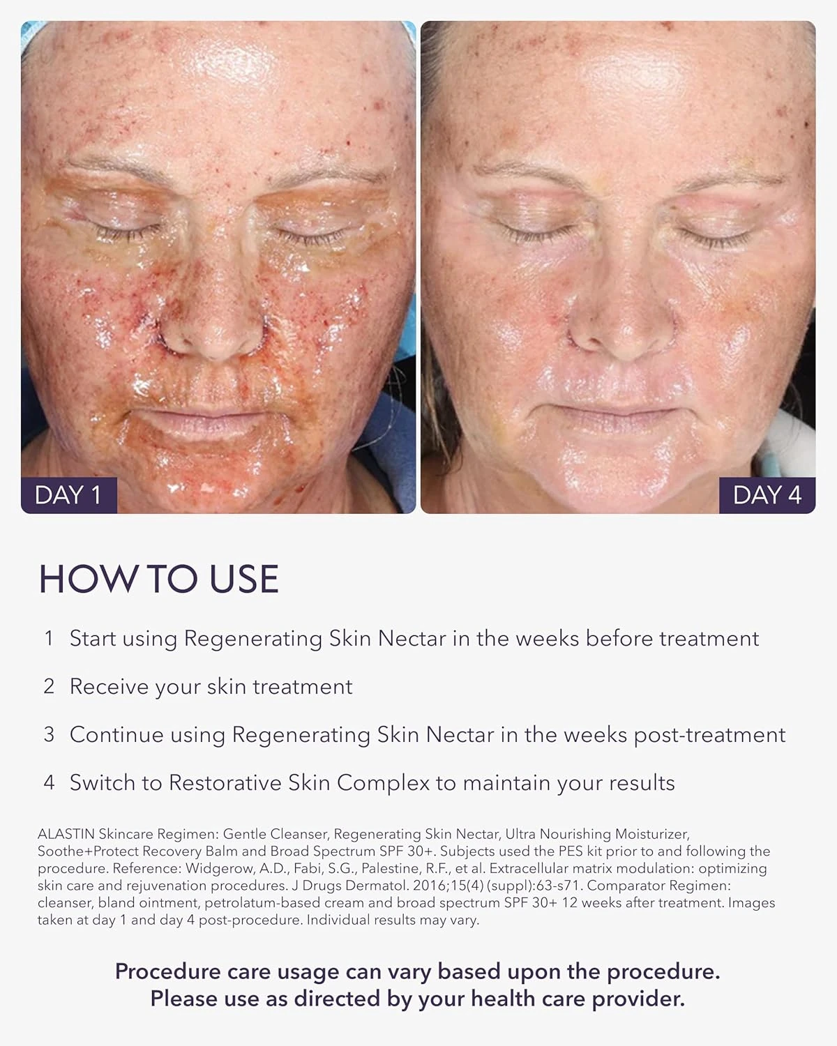 ALASTIN Skincare Regenerating Skin Nectar Face Moisturizer (1 oz) | Hydrating Se