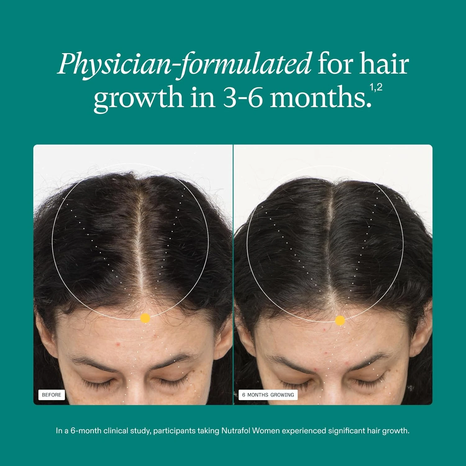 Nutrafol Women Hair Growth Supplement. Clinically Proven for Visibly Thicker, St
