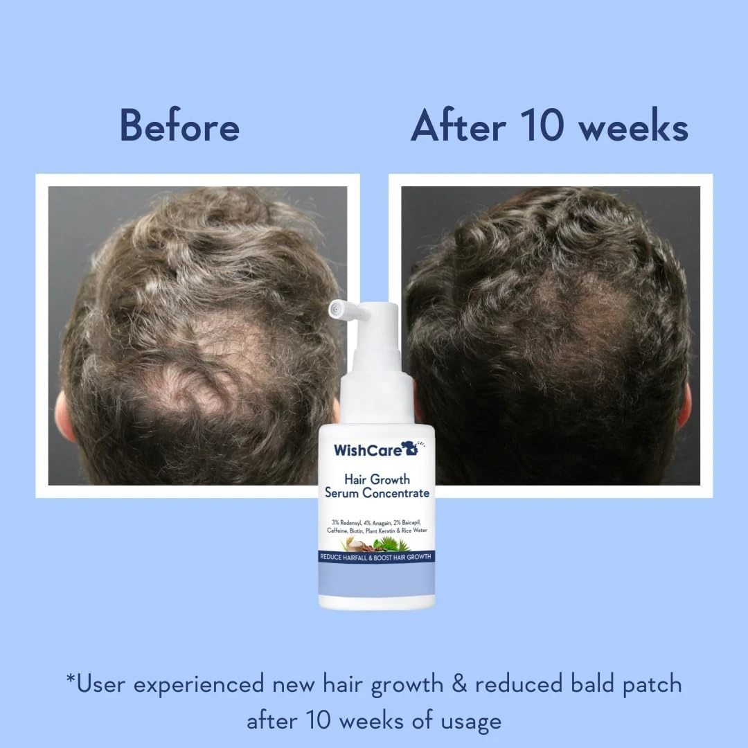 WishCare Hair Growth Serum Concentrate - 3% Redensyl, 4% Anagain, 2% Baicapil, C