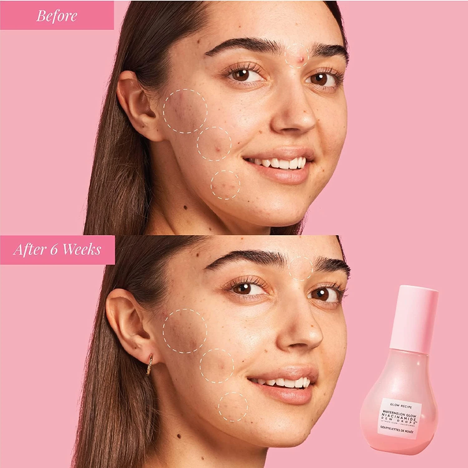Glow Recipe Niacinamide Dew Drops Face Serum - Hydrating Korean Skincare & Illum